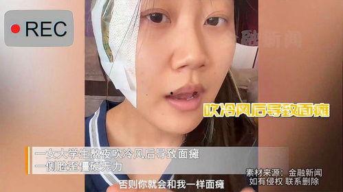 面瘫视频,从视频看面瘫的典型表现